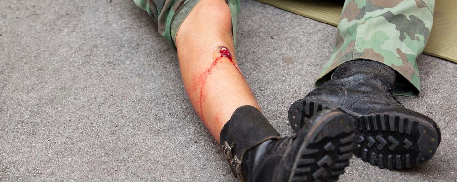 Surviving a Gunshot